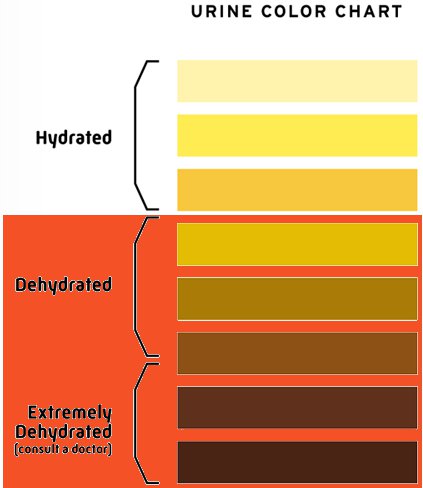 urine color10